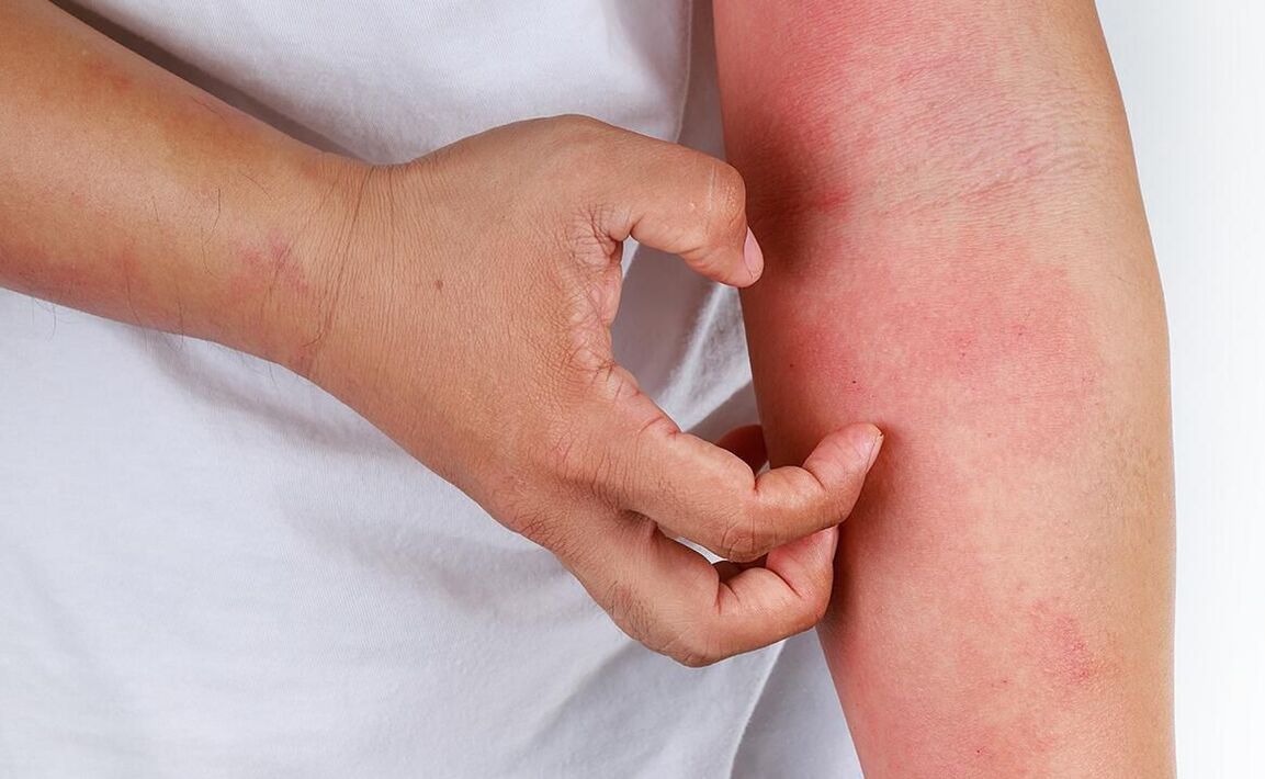 võimalikud tüsistused sooda kasutamisest