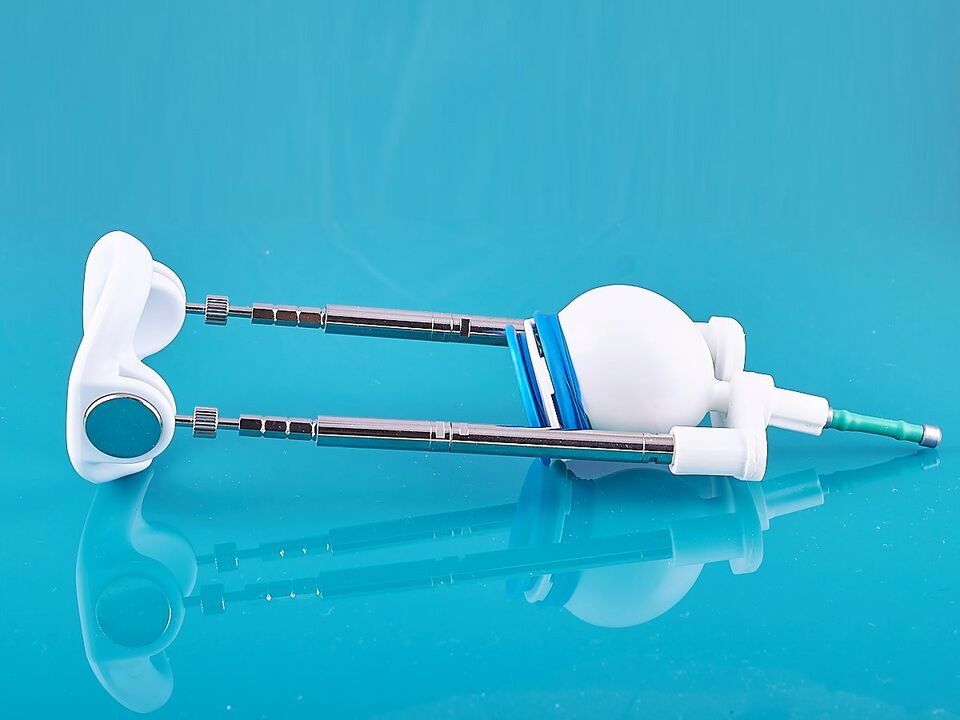 Extender aitab parandada ligamentotoomia tulemust